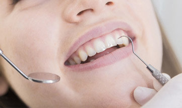 Tratamento Periodontal 2
